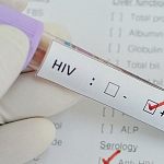 Любой житель Подмосковья может бесплатно и анонимно сдать анализ на наличие ВИЧ-инфекции 