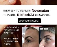 ВСТРЕЧАЙ ВЕСНУ С РОВНОЙ И СИЯЮЩЕЙ КОЖЕЙ!