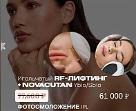 13 и 14 МАРТА — ДНИ ВЫСОКИХ ТЕХНОЛОГИЙ InMode