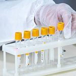 Бесплатная сдача анализов для оценки риска сердечно-сосудистых заболеваний