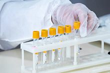 Бесплатная сдача анализов для оценки риска сердечно-сосудистых заболеваний